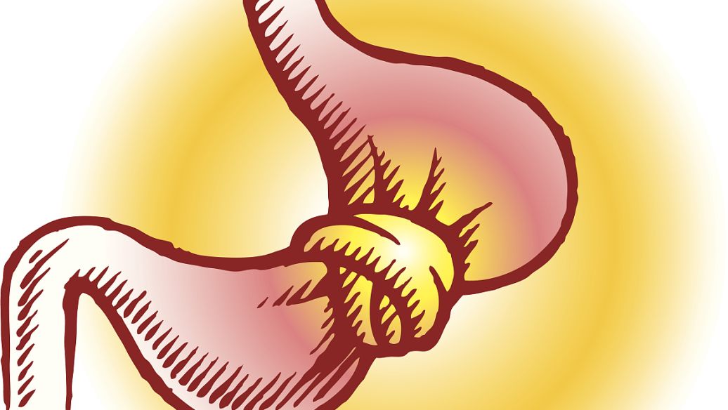 Trans-Cinnamaldehyde uses | Shaanxi BLOOM Tech Co., Ltd Trans-Cinnamaldehyde uses | Shaanxi BLOOM Tech Co., Ltd