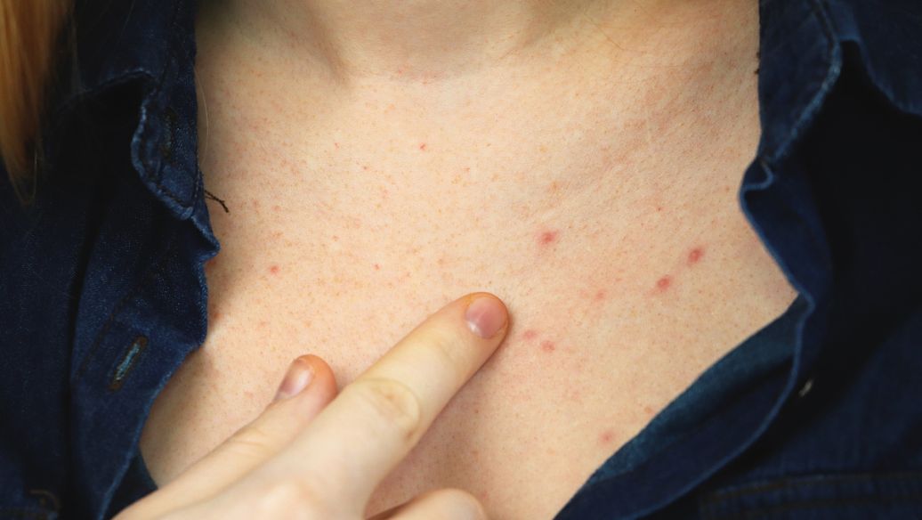 Prilocaine ointment uses | Shaanxi BLOOM Tech Co., Ltd Prilocaine ointment uses | Shaanxi BLOOM Tech Co., Ltd