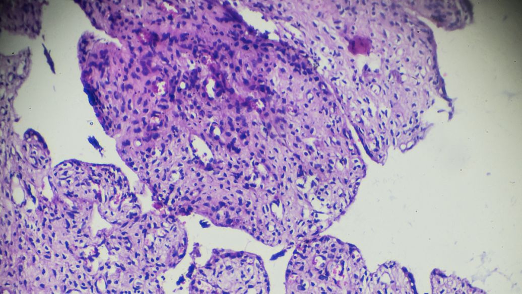 SLU-PP-332 Muscle Fiber Type Transitions | Shaanxi BLOOM Tech Co., Ltd SLU-PP-332 Muscle Fiber Type Transitions | Shaanxi BLOOM Tech Co., Ltd
