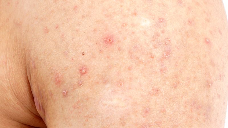 Ethylenediaminetetraacetic Acid(edta) uses CAS 60-00-4 | Shaanxi BLOOM Tech Co., Ltd Ethylenediaminetetraacetic Acid(edta) uses CAS 60-00-4 | Shaanxi BLOOM Tech Co., Ltd