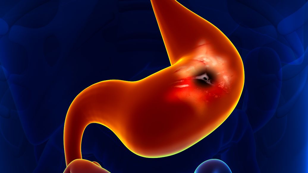 Bioglutide NA-931 cost | Shaanxi BLOOM Tech Co., Ltd Bioglutide NA-931 cost | Shaanxi BLOOM Tech Co., Ltd