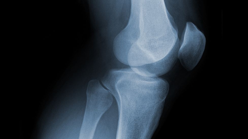 Calcitonin salmon price | Shaanxi BLOOM Tech Co., Ltd Calcitonin salmon price | Shaanxi BLOOM Tech Co., Ltd