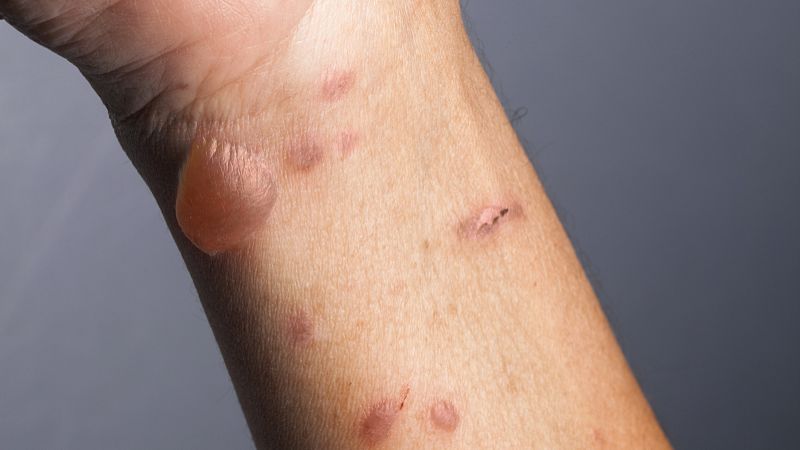 Fluralaner Solution uses | Shaanxi BLOOM Tech Co., Ltd Fluralaner Solution uses | Shaanxi BLOOM Tech Co., Ltd