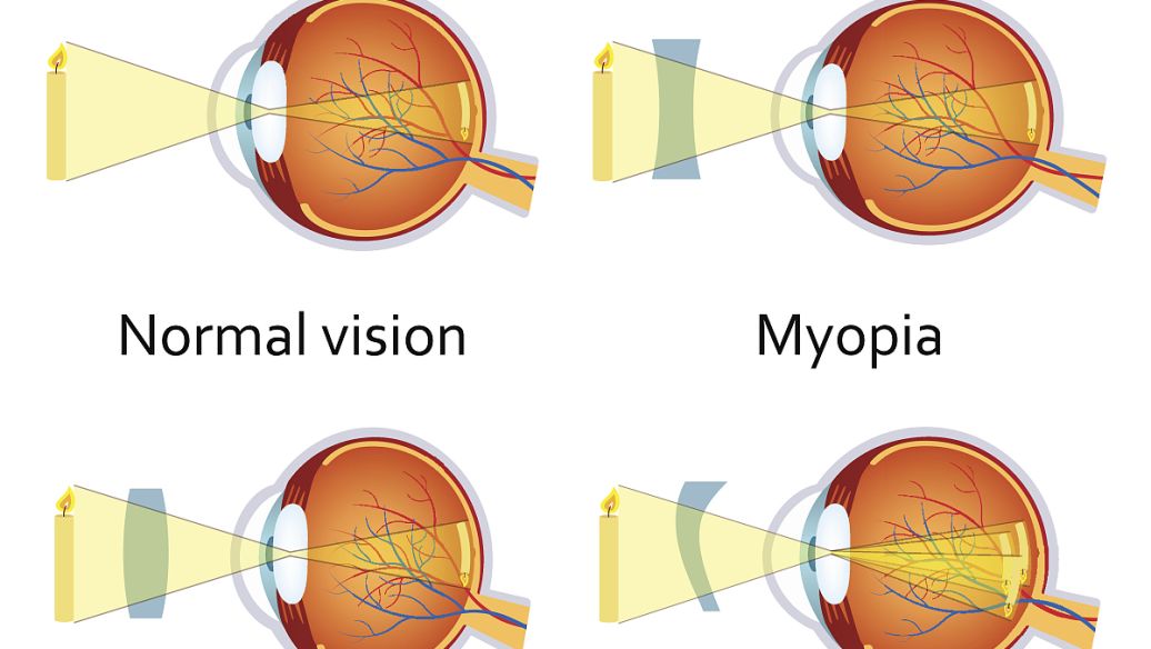 atropine sulfate uses | Shaanxi BLOOM Tech Co., Ltd atropine sulfate uses | Shaanxi BLOOM Tech Co., Ltd