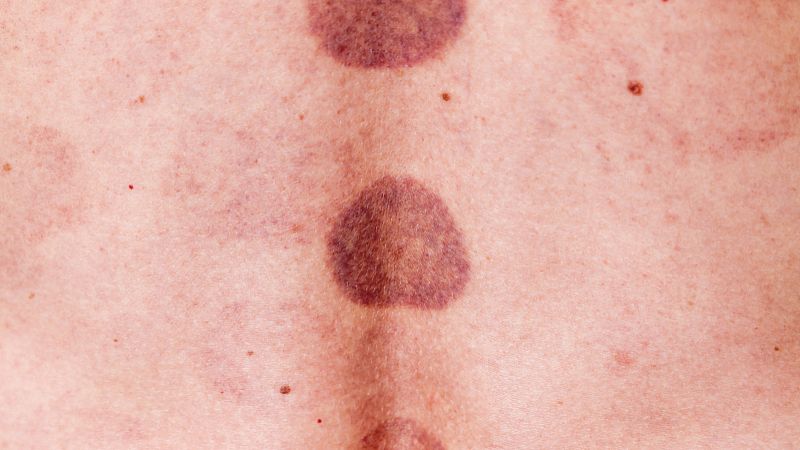 Benzyl benzoate uses | Shaanxi BLOOM Tech Co., Ltd