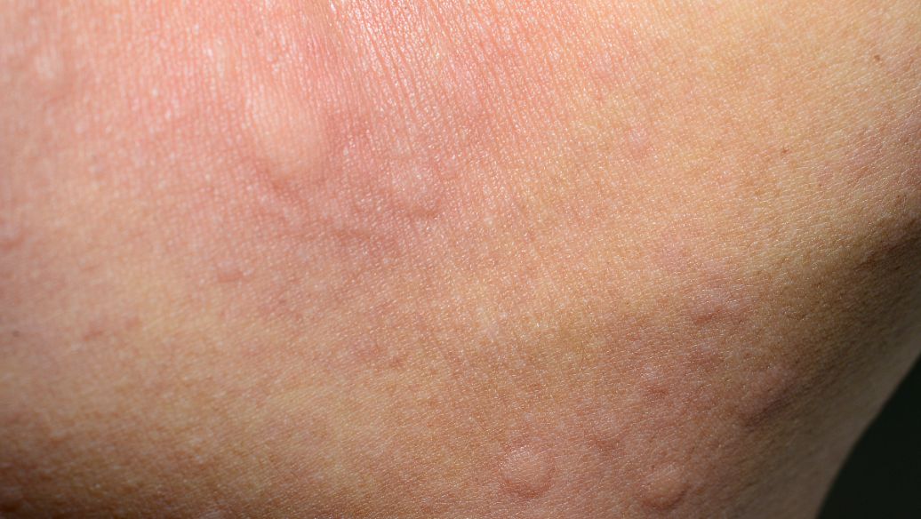 Choline glycerophosphate food | Shaanxi BLOOM Tech Co., Ltd Choline glycerophosphate food | Shaanxi BLOOM Tech Co., Ltd