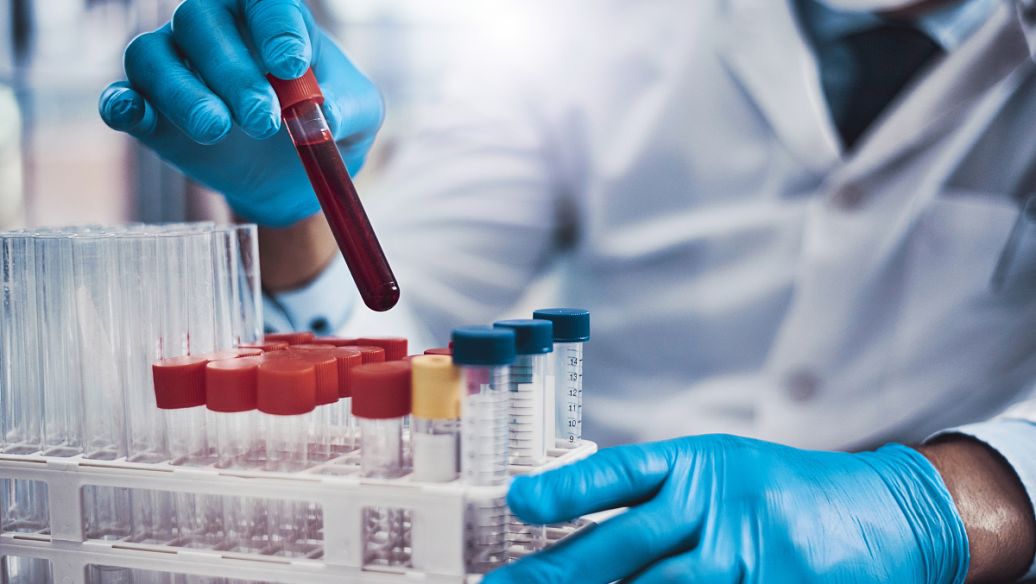 GS441524 uses | Shaanxi BLOOM Tech Co., Ltd