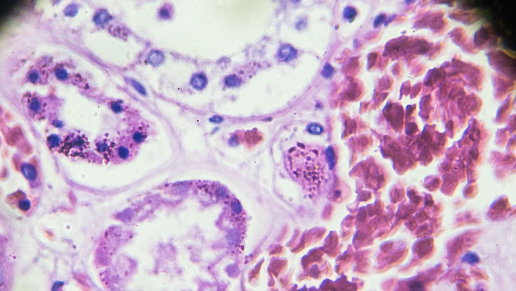 Fluorescein Diacetate uses | Shaanxi BLOOM Tech Co., Ltd Fluorescein Diacetate uses | Shaanxi BLOOM Tech Co., Ltd