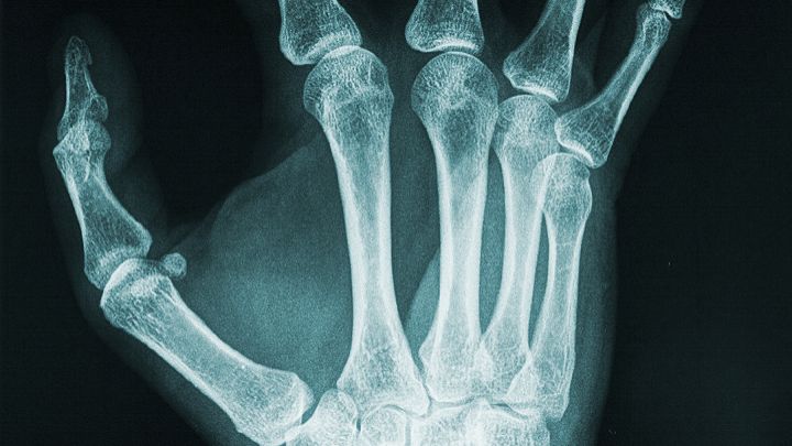 Teriparatide price | Shaanxi BLOOM Tech Co., Ltd Teriparatide price | Shaanxi BLOOM Tech Co., Ltd