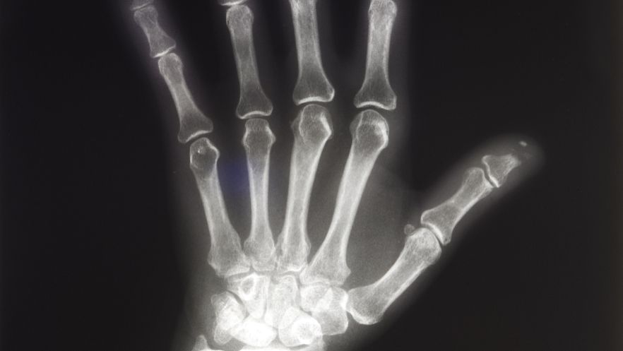 SLU-PP-332 Capsules suppliers | Shaanxi BLOOM Tech Co., Ltd