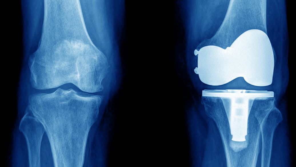 CJC 1295 fitness | Shaanxi BLOOM Tech Co., Ltd CJC 1295 fitness | Shaanxi BLOOM Tech Co., Ltd