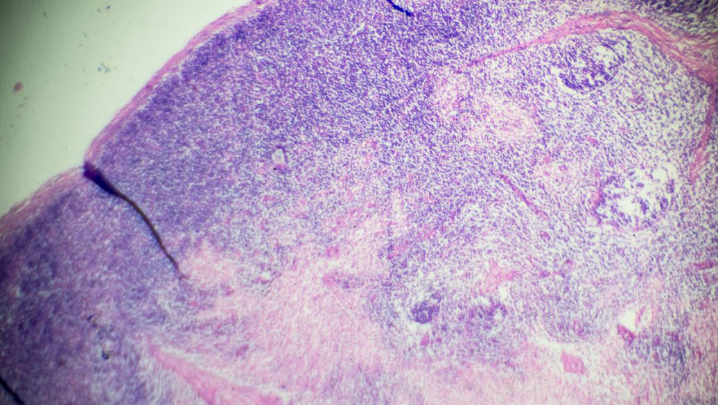 octreotide acetate uses | Shaanxi BLOOM Tech Co., Ltd octreotide acetate uses | Shaanxi BLOOM Tech Co., Ltd