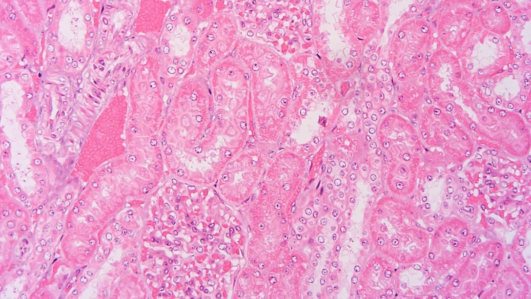 Fast Blue B salt uses CAS 14263-94-6 | Shaanxi BLOOM Tech Co., Ltd Fast Blue B salt uses CAS 14263-94-6 | Shaanxi BLOOM Tech Co., Ltd