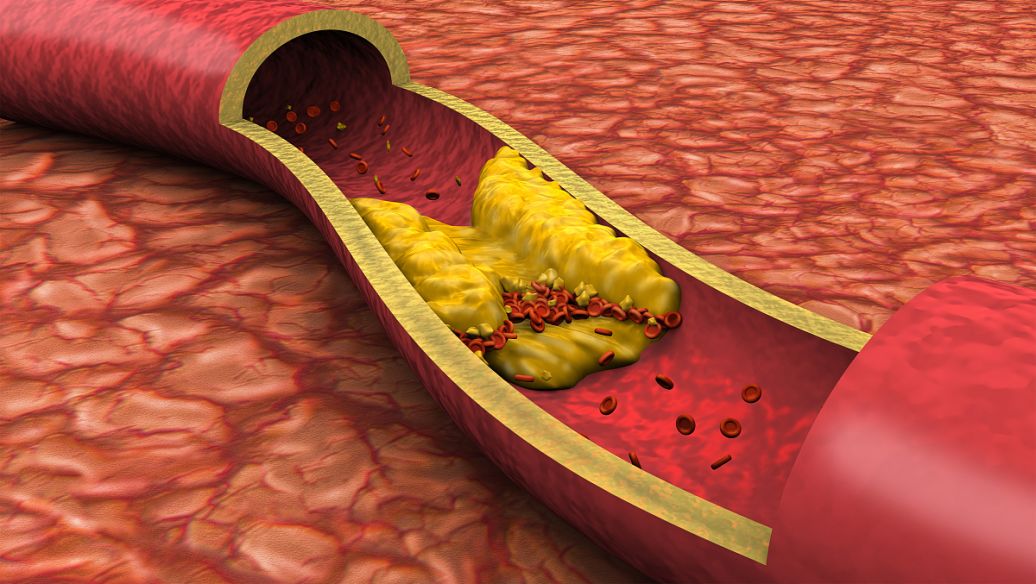 Vapreotide Development prospects | Shaanxi BLOOM Tech Co., Ltd Vapreotide Development prospects | Shaanxi BLOOM Tech Co., Ltd