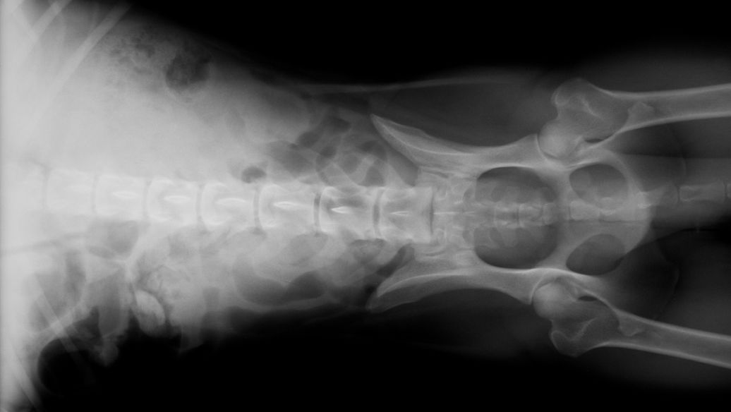 Teriparatide Sustained-Release Systems | Shaanxi BLOOM Tech Co., Ltd Teriparatide Sustained-Release Systems | Shaanxi BLOOM Tech Co., Ltd