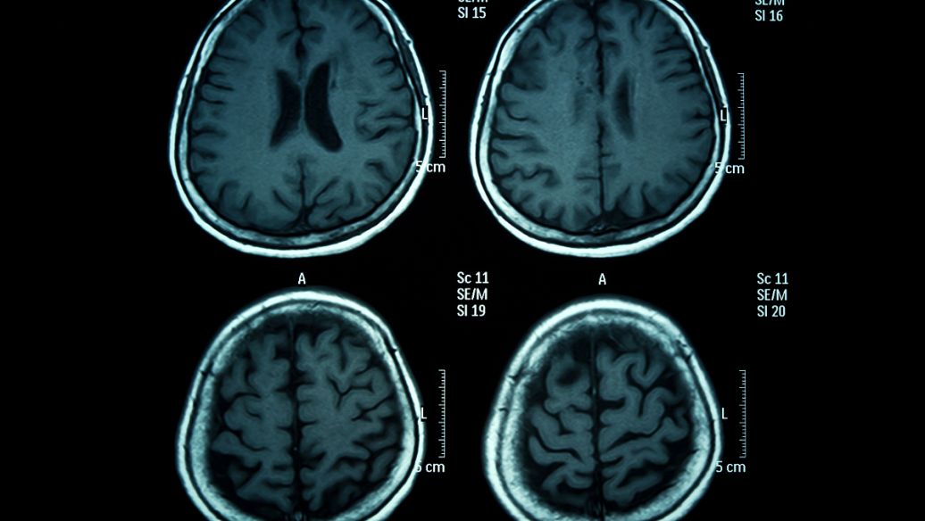 GABA uses | Shaanxi BLOOM Tech Co., Ltd GABA uses | Shaanxi BLOOM Tech Co., Ltd