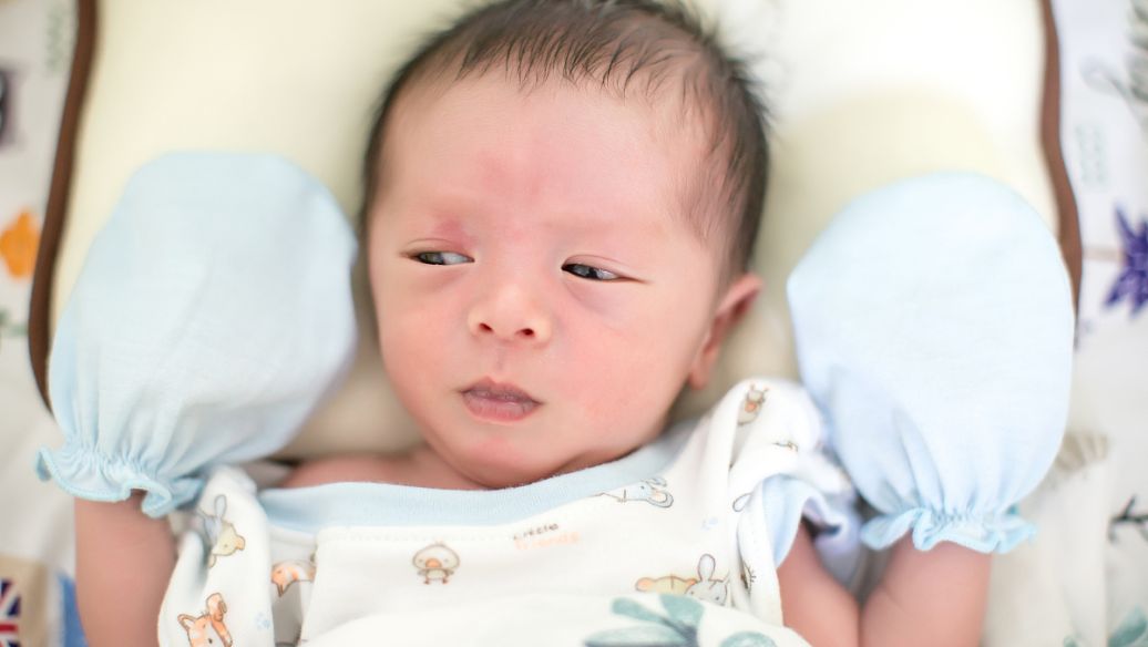 黑毛痣胎记去除手术一般多少钱