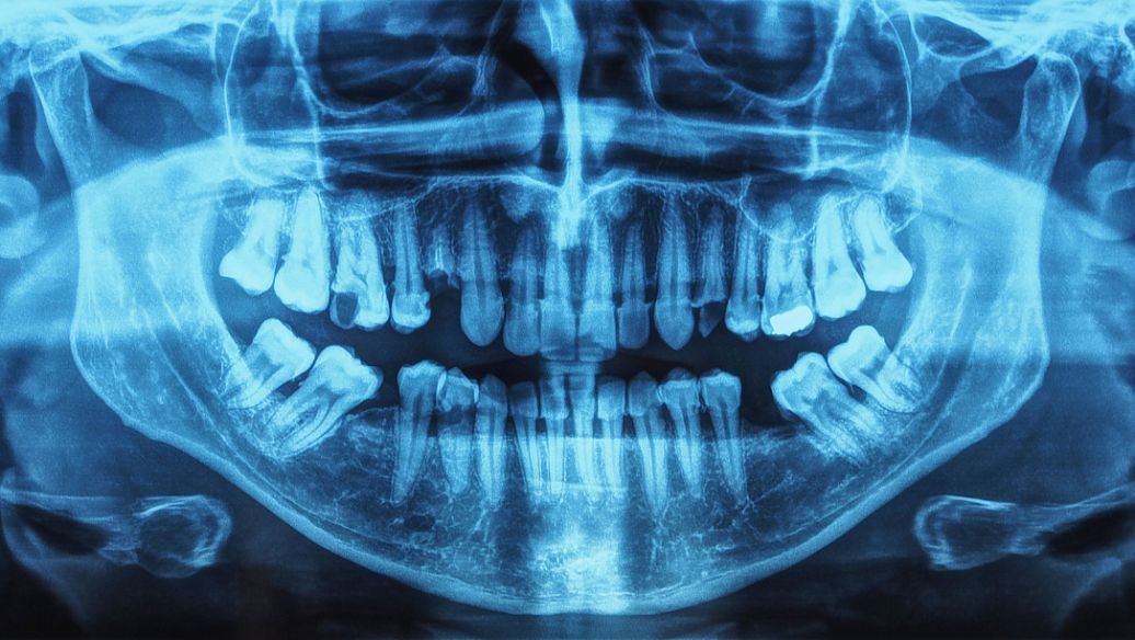Teriparatide Preclinical studies | Shaanxi BLOOM Tech Co., Ltd Teriparatide Preclinical studies | Shaanxi BLOOM Tech Co., Ltd