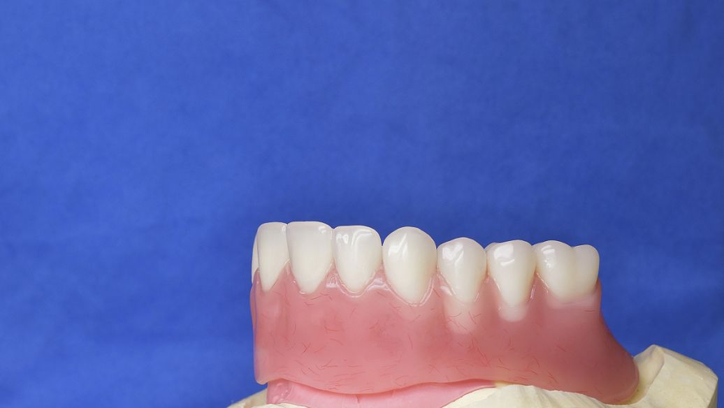 刚摘牙套感觉舌头舔牙齿后面有拉丝的感觉呀她与秋风