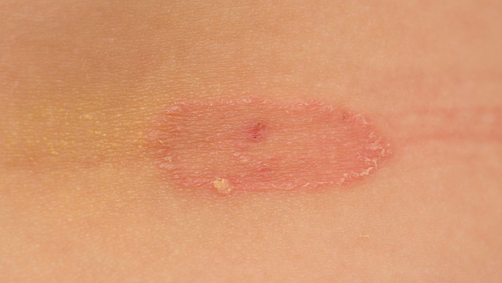 Filgotinib uses | Shaanxi BLOOM Tech Co., Ltd Filgotinib uses | Shaanxi BLOOM Tech Co., Ltd