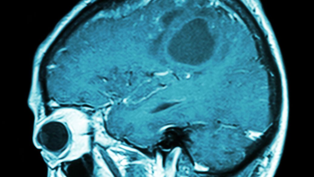 Memantine HCl for sales | Shaanxi BLOOM Tech Co., Ltd Memantine HCl for sales | Shaanxi BLOOM Tech Co., Ltd