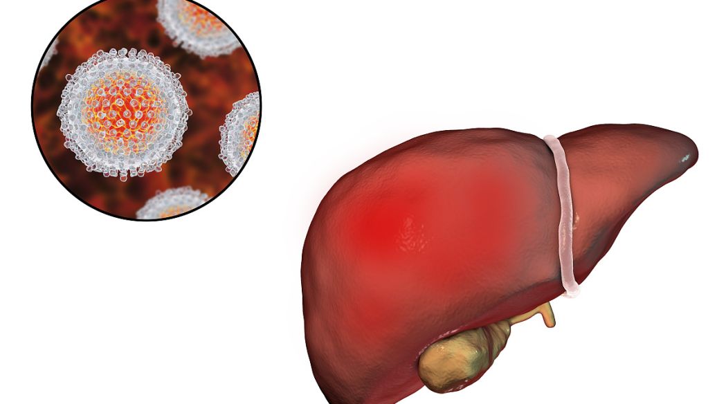 Meldonium uses | Shaanxi BLOOM Tech Co., Ltd Meldonium uses | Shaanxi BLOOM Tech Co., Ltd