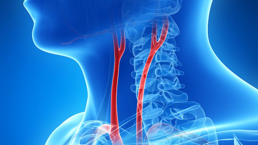 Aceglutamide pain | Shaanxi BLOOM Tech Co., Ltd Aceglutamide pain | Shaanxi BLOOM Tech Co., Ltd