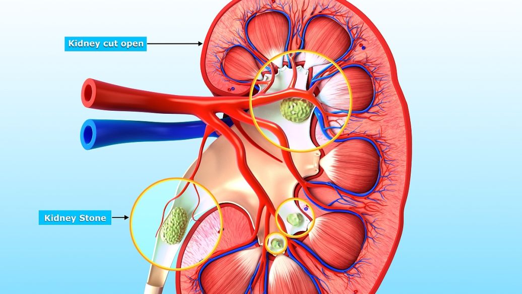 cjc 1295 renal | Shaanxi BLOOM Tech Co., Ltd
