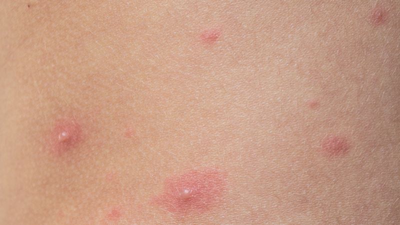 Fluralaner Solution uses | Shaanxi BLOOM Tech Co., Ltd Fluralaner Solution uses | Shaanxi BLOOM Tech Co., Ltd