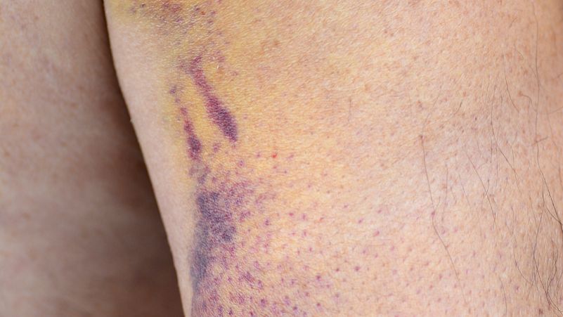 Glutathione purchase | Shaanxi BLOOM Tech Co., Ltd Glutathione purchase | Shaanxi BLOOM Tech Co., Ltd