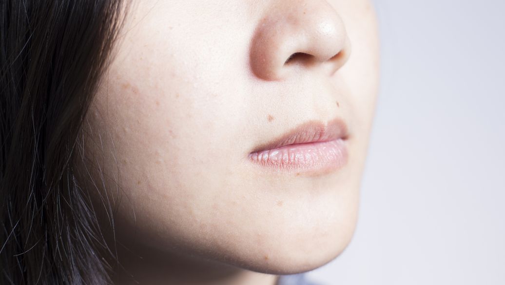 Nad+ skin | Shaanxi BLOOM Tech Co., Ltd