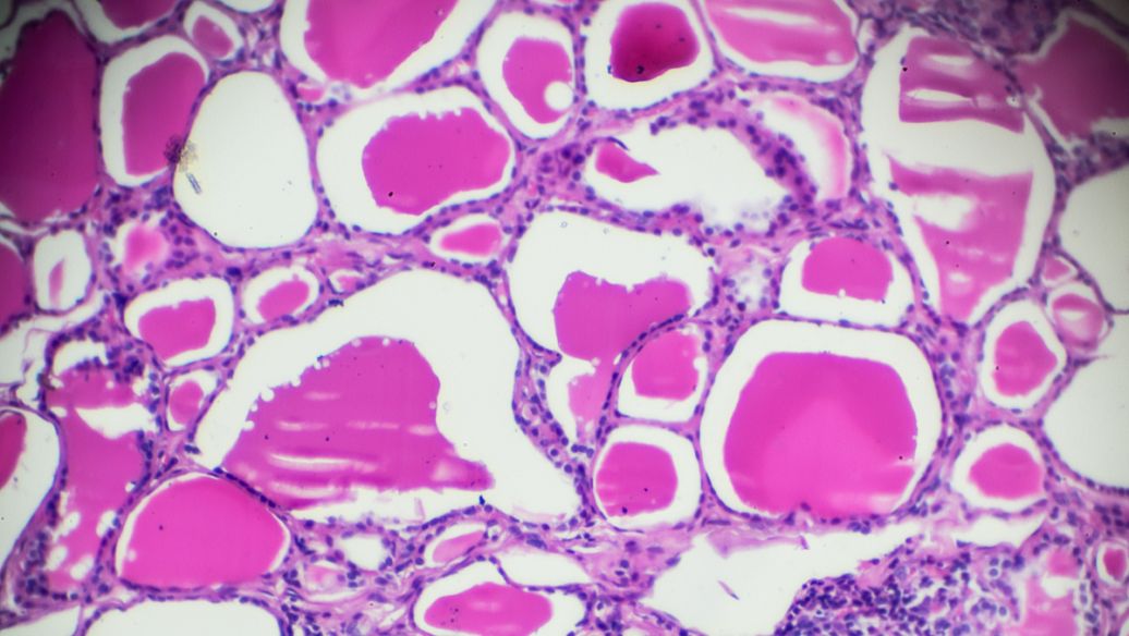 KPV research | Shaanxi BLOOM Tech Co., Ltd KPV research | Shaanxi BLOOM Tech Co., Ltd