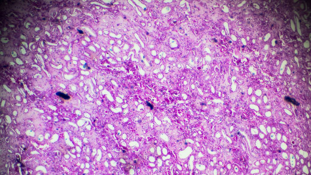 octreotide acetate uses | Shaanxi BLOOM Tech Co., Ltd octreotide acetate uses | Shaanxi BLOOM Tech Co., Ltd