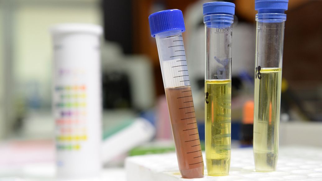 Tetrazolium Blue Chloride uses CAS 1871-22-3 | Shaanxi BLOOM Tech Co., Ltd