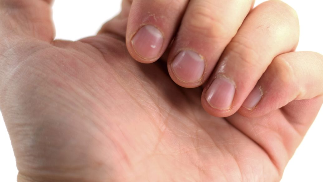 Ciclopirox ethanolamine | Shaanxi BLOOM Tech Co., Ltd Ciclopirox ethanolamine | Shaanxi BLOOM Tech Co., Ltd