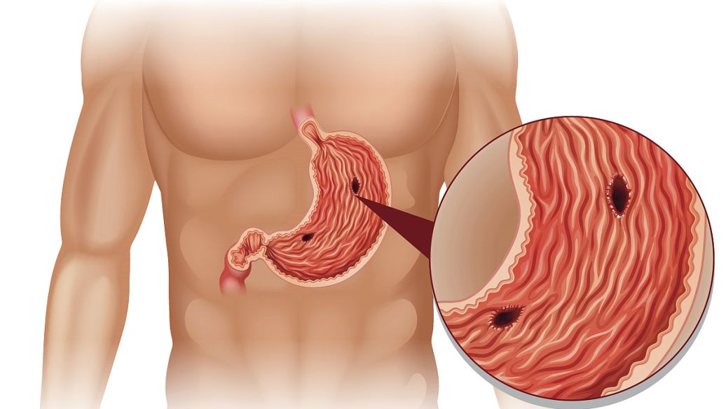 Semaglutide renal | Shaanxi BLOOM Tech Co., Ltd Semaglutide renal | Shaanxi BLOOM Tech Co., Ltd