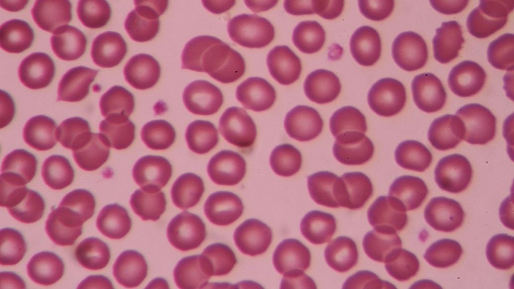 Hexarelin buy | Shaanxi BLOOM Tech Co., Ltd