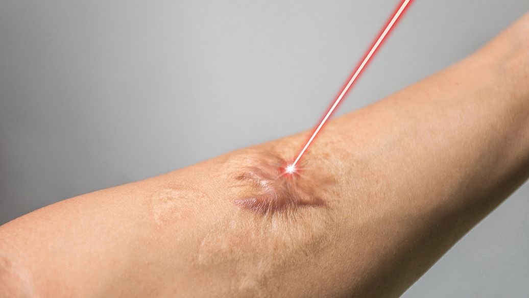 cjc 1295 scar | Shaanxi BLOOM Tech Co., Ltd cjc 1295 scar | Shaanxi BLOOM Tech Co., Ltd