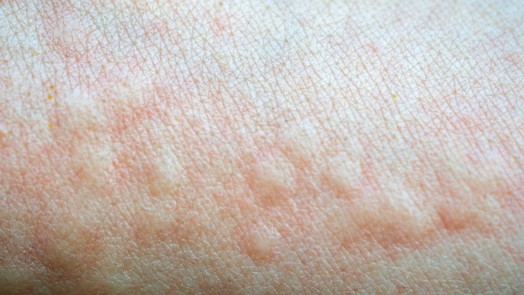 SLU-PP-332 medicines | Shaanxi BLOOM Tech Co., Ltd SLU-PP-332 medicines | Shaanxi BLOOM Tech Co., Ltd