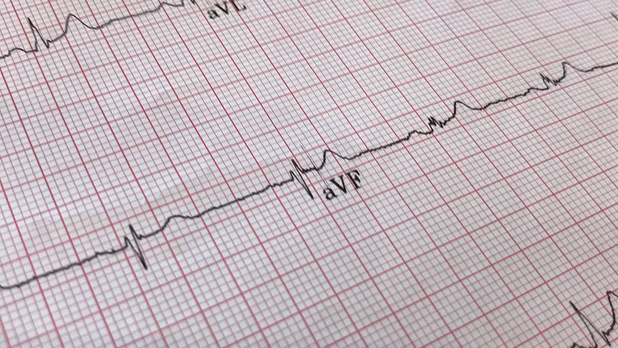 Diltiazem purchase | Shaanxi BLOOM Tech Co., Ltd
