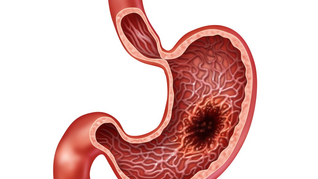 Betaine Hcl drug | Shaanxi BLOOM Tech Co., Ltd Betaine Hcl drug | Shaanxi BLOOM Tech Co., Ltd