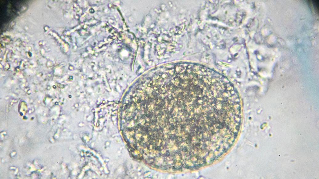 Mycophenolic Acid Antifungal effect | Shaanxi BLOOM Tech Co., Ltd Mycophenolic Acid Antifungal effect | Shaanxi BLOOM Tech Co., Ltd