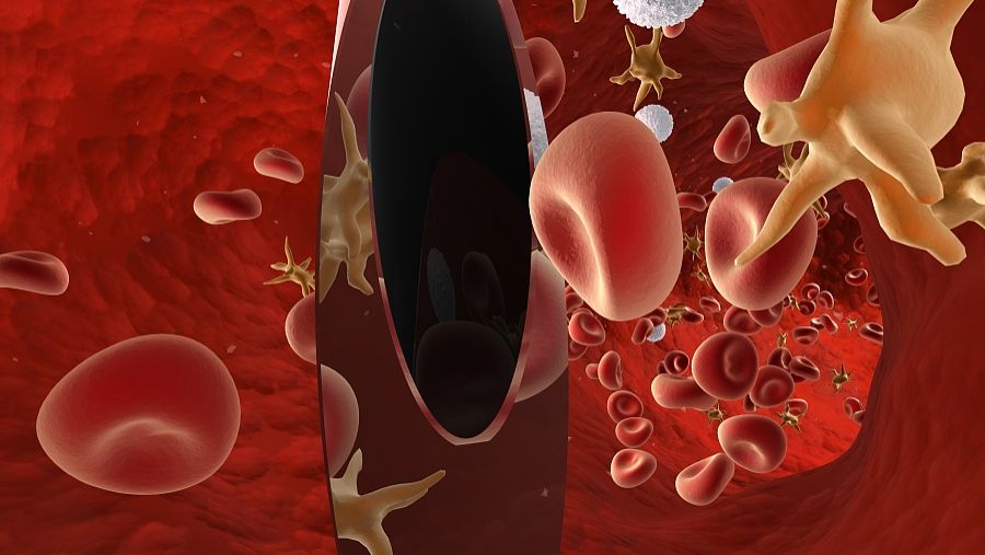 Semaglutide blood sugar | Shaanxi BLOOM Tech Co., Ltd Semaglutide blood sugar | Shaanxi BLOOM Tech Co., Ltd